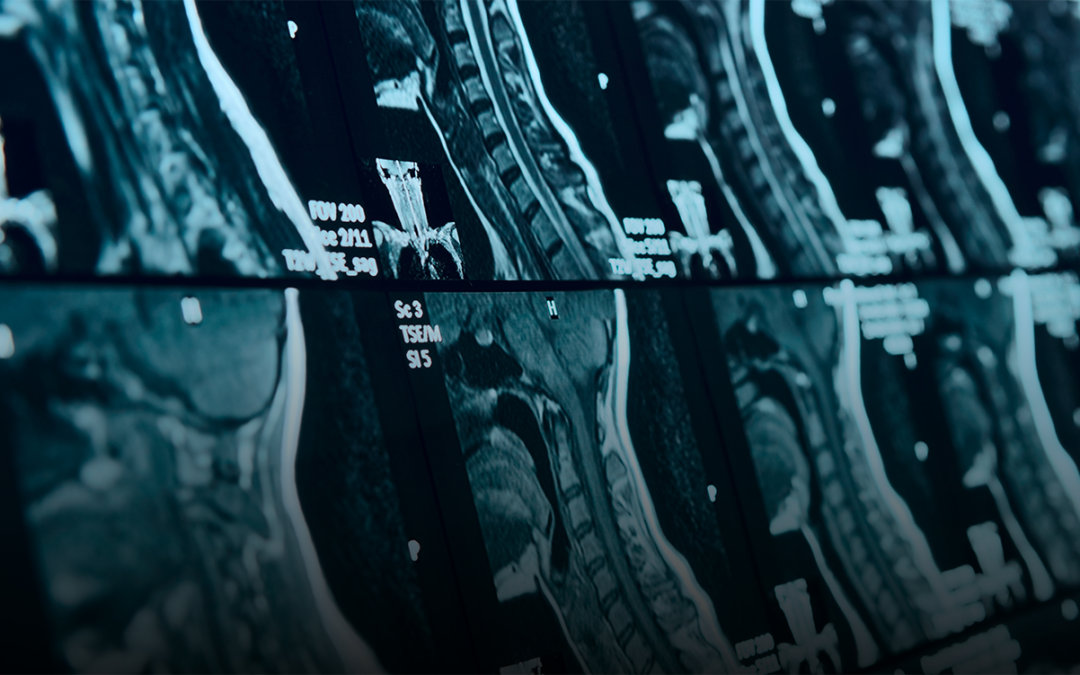 The Essential Role of MRI Training in Modern Chiropractic Practice